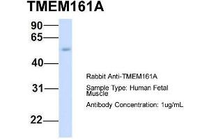 Host:  Rabbit  Target Name:  TMEM161A  Sample Type:  Human Fetal Muscle  Antibody Dilution:  1. (TMEM161A antibody  (Middle Region))