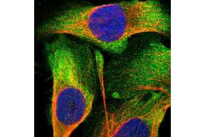 Immunofluorescent staining of human cell line U-2 OS shows localization to plasma membrane & cytosol. (METAP2 antibody  (AA 10-101))
