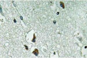 Immunohistochemistry (IHC) analyzes of PAH antibody in paraffin-embedded human brain tissue. (Phenylalanine Hydroxylase antibody)