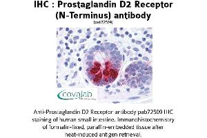 Image no. 1 for anti-Prostaglandin D2 Receptor (PTGDR) (Extracellular Domain), (N-Term) antibody (ABIN1738422) (PTGDR antibody  (Extracellular Domain, N-Term))