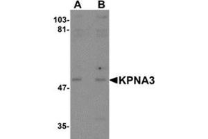 Western blot analysis of KPNA3 in EL4 cell lysate with KPNA3 antibody at (A) 1 and (B) 2 μg/ml. (KPNA3 antibody  (C-Term))