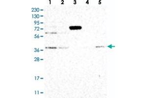 Western blot analysis of Lane 1: RT-4, Lane 2: U-251 MG, Lane 3: Human Plasma, Lane 4: Liver, Lane 5: Tonsil with STRAP polyclonal antibody  at 1:250-1:500 dilution. (STRAP antibody)