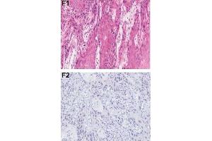 Immunohistochemistry (IHC) image for anti-Programmed Cell Death 4 (PDCD4) (pSer457) antibody (ABIN129708)