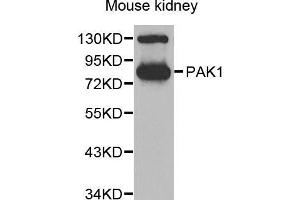 Western blot analysis of extracts of mouse kidney, using PAK1 antibody (ABIN5971674) at 1:700 dilution.