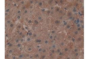Detection of ADCY3 in Human Liver Tissue using Polyclonal Antibody to Adenylate Cyclase 3 (ADCY3)