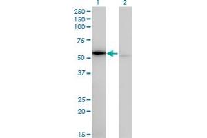 Western Blot analysis of WARS expression in transfected 293T cell line by WARS monoclonal antibody (M02), clone 3A12.