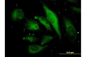 Immunofluorescence of monoclonal antibody to MAPRE2 on HeLa cell. (MAPRE2 antibody  (AA 1-62))