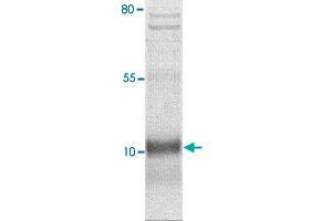 The cell lysate derived from MCF-7 was immuno-blotted by SCGB2A1 polyclonal antibody  at 1 : 500. (Mammaglobin A antibody  (Internal Region))