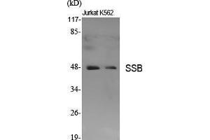 Western Blot (WB) analysis of specific cells using SSB Polyclonal Antibody. (SSB antibody  (Ser366))