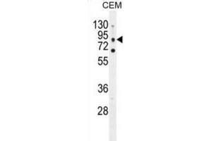 Western Blotting (WB) image for anti-Chloride Channel, Voltage-Sensitive 7 (CLCN7) antibody (ABIN2996411)