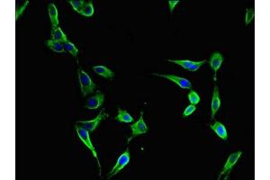 Immunofluorescent analysis of Hela cells using ABIN7152398 at dilution of 1:100 and Alexa Fluor 488-congugated AffiniPure Goat Anti-Rabbit IgG(H+L) (FBXL22 antibody  (AA 123-229))