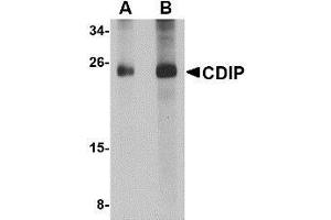 Western blot analysis of CDIP in human brain lysate with AP30219PU-N CDIP antibody at (A) 1 and (B) 2 μg/ml. (CDIP1 antibody  (Center))