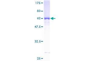 SULT1A3 Protein (AA 1-295) (GST tag)