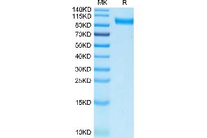SDS-PAGE (SDS) image for AXL Receptor tyrosine Kinase (AXL) (AA 26-449) protein (Fc Tag,Biotin) (ABIN7273883)