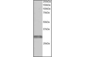 Antibody staining (1 µg/ml) of Human Muscle lysate (RIPA buffer, 30 µg total protein per lane). (TRIM7 antibody  (C-Term))