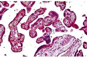 Human Placenta: Formalin-Fixed, Paraffin-Embedded (FFPE) (Sorting Nexin 4 antibody  (AA 438-450))