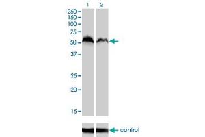 Western blot analysis of NRF1 over-expressed 293 cell line, cotransfected with NRF1 Validated Chimera RNAi (Lane 2) or non-transfected control (Lane 1). (NRF1 antibody  (AA 201-285))