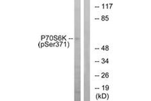 Western blot analysis of extracts from COLO205 cells treated with serum 20% 15', using p70 S6 Kinase (Phospho-Ser371) Antibody. (RPS6KB1 antibody  (pSer371))