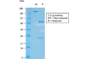 SDS-PAGE Analysis of Purified CD27 Rabbit Recombinant Monoclonal Antibody (LPFS2/2034R).