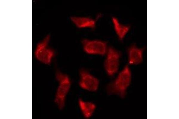 OR6T1 antibody  (C-Term)