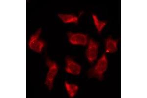 ABIN6276184 staining HeLa by IF/ICC. (OR6T1 antibody  (C-Term))