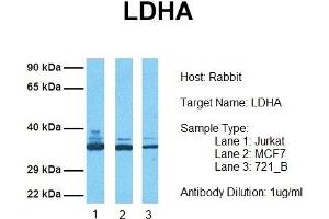 Host: Rabbit Target Name: LDHA Sample Tissue: Human Jurkat, MCF7, 721_B Antibody Dilution: 1. (Lactate Dehydrogenase A antibody  (Middle Region))