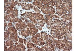 Image no. 4 for anti-Mitogen-Activated Protein Kinase Kinase 1 (MAP2K1) antibody (ABIN1499388) (MEK1 antibody)