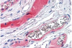 Human Small Intestine, Vessels (formalin-fixed, paraffin-embedded) stained with KLKB1 antibody ABIN351494 at 5 ug/ml followed by biotinylated secondary antibody, alkaline phosphatase-streptavidin and chromogen. (KLKB1 antibody)