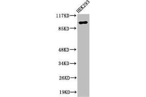 Western Blot analysis of 293 cells using RoXaN Polyclonal Antibody (ZC3H7B antibody  (C-Term))