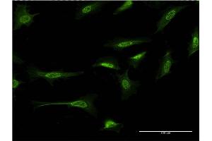 Immunofluorescence of monoclonal antibody to CTNND2 on HeLa cell. (CTNND2 antibody  (AA 1081-1190))