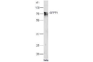 Human HeLa lysates probed with Rabbit Anti-GFPT1 Polyclonal Antibody, Unconjugated (ABIN1714093) at 1:300 overnight at 4˚C. (GFPT1 antibody  (AA 601-699))