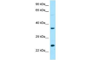 WB Suggested Anti-DTD1 Antibody Titration: 1. (DTD1 antibody  (C-Term))