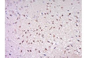 Paraformaldehyde-fixed, paraffin embedded mouse brain, Antigen retrieval by boiling in sodium citrate buffer (pH6) for 15min, Block endogenous peroxidase by 3% hydrogen peroxide for 30 minutes, Blocking buffer (normal goat serum) at 37°C for 20min, Antibody incubation with Rabbit Anti-Cdc25B (Ser186) Polyclonal Antibody, Unconjugated  at 1:500 overnight at 4°C, followed by a conjugated secondary for 90 minutes and DAB staining. (CDC25B antibody  (pSer186))