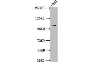 Western Blot Positive WB detected in: U251 whole cell lysate All lanes: MME antibody at 1:1500 Secondary Goat polyclonal to rabbit IgG at 1/50000 dilution Predicted band size: 86 kDa Observed band size: 100 kDa (Recombinant MME antibody)