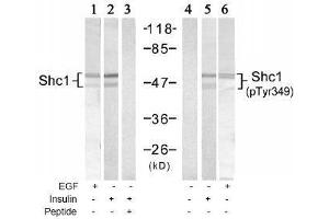Image no. 1 for anti-SHC (Src Homology 2 Domain Containing) Transforming Protein 1 (SHC1) (pTyr349) antibody (ABIN197085) (SHC1 antibody  (pTyr349))