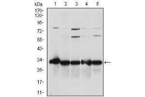 NQO1 antibody