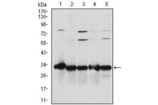 NQO1 antibody