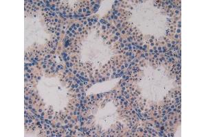 Used in DAB staining on fromalin fixed paraffin- embedded testis tissue