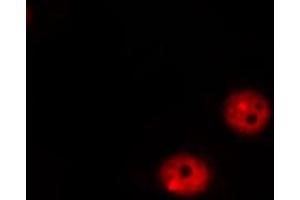 ABIN6267317 staining MOLT by IF/ICC. (Retinoblastoma 1 antibody  (pSer807))