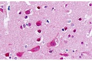 Human Brain, Cortex: Formalin-Fixed, Paraffin-Embedded (FFPE) (CYP2B6 antibody  (AA 241-290))