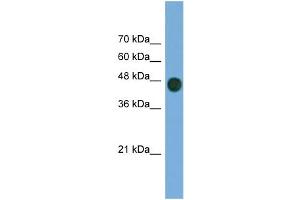 WB Suggested Anti-ARFGAP1 Antibody Titration: 0.