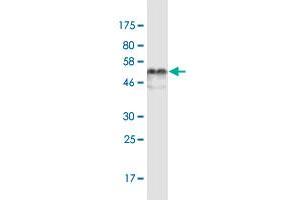 Western Blot detection against Immunogen (53. (Elastase 3B antibody  (AA 19-270))