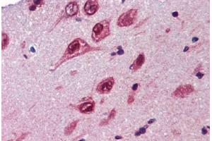 Human Brain, Cortex (formalin-fixed, paraffin-embedded) stained with UBQLN1 antibody ABIN462260 followed by biotinylated goat anti-rabbit IgG secondary antibody ABIN481713, alkaline phosphatase-streptavidin and chromogen. (Ubiquilin 1 antibody  (AA 290-339))