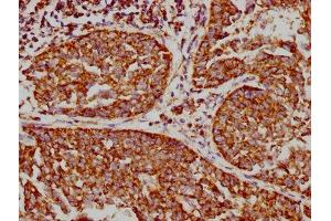 IHC image of ABIN7127868 diluted at 1:73. (Recombinant VDAC1 antibody)