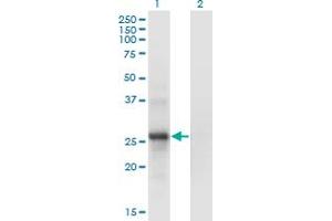 Western Blot analysis of SNF8 expression in transfected 293T cell line by SNF8 monoclonal antibody (M01), clone 6B11.