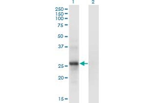 SNF8 anticorps  (AA 23-122)