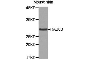 Western Blotting (WB) image for anti-RAB8B, Member RAS Oncogene Family (RAB8B) antibody (ABIN1875675) (RAB8B antibody)
