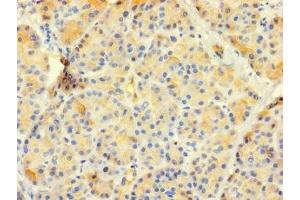 Immunohistochemistry of paraffin-embedded human pancreatic tissue using ABIN7147746 at dilution of 1:100 (CTRB1 antibody  (AA 19-263))