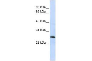 RTN1 antibody used at 1 ug/ml to detect target protein.
