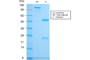 SDS-PAGE Analysis Purified CD79b Recombinant Rabbit Monoclonal Antibody (IGB/3170R). (Recombinant CD79b antibody  (AA 29-159))
